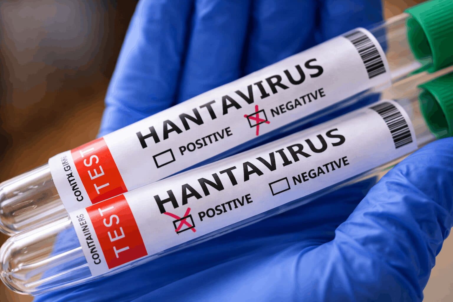 Hantavirus Cases Rise After MV Hondius Cruise Outbreak Kills Three